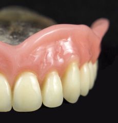 Complete Denture