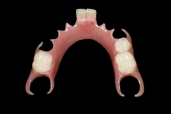 Flexite Flexible Denture