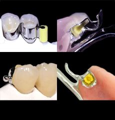 Ceka Precision Attachments