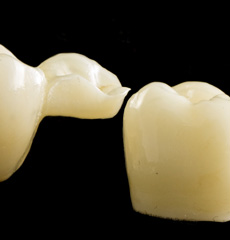Prettau Full Zirconium