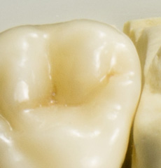 Prettau Full Zirconium