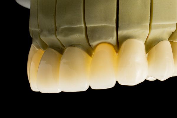 Zirkonzahn Prettau Full Anatomic Zirconium Crown