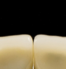 Full Zirconium Occlusion
