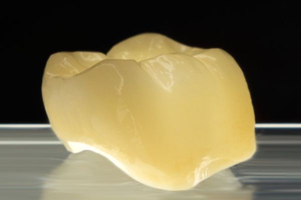 Aidite Full Anatomic Zirconium Crown