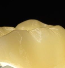 Aidite Full Anatomic Zirconium Crown