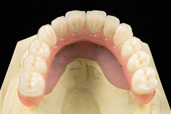 Porcelain Zirconium Inlay Bridge