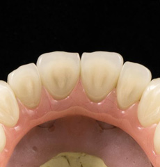 Superstructure with Crowns