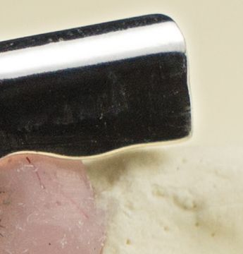 Implant Bar Overdentures