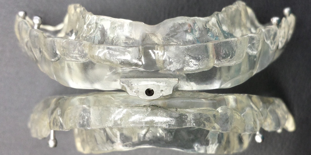TAP Splint