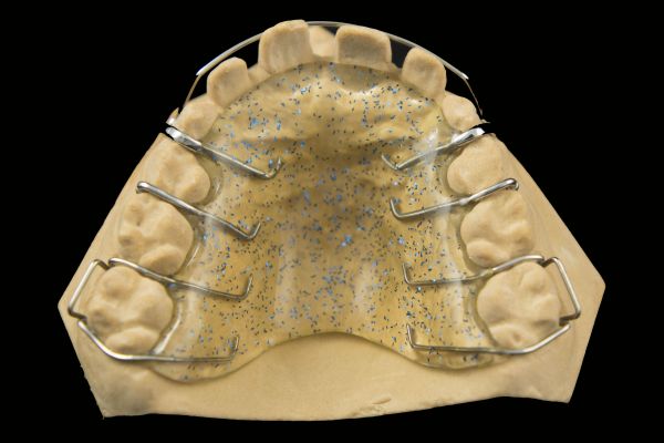 Orthodontic Appliances