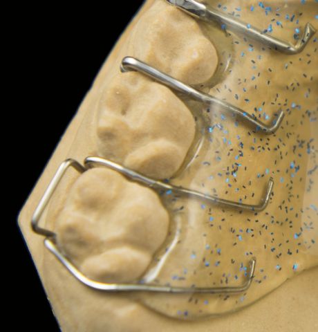 Orthodontic Appliances